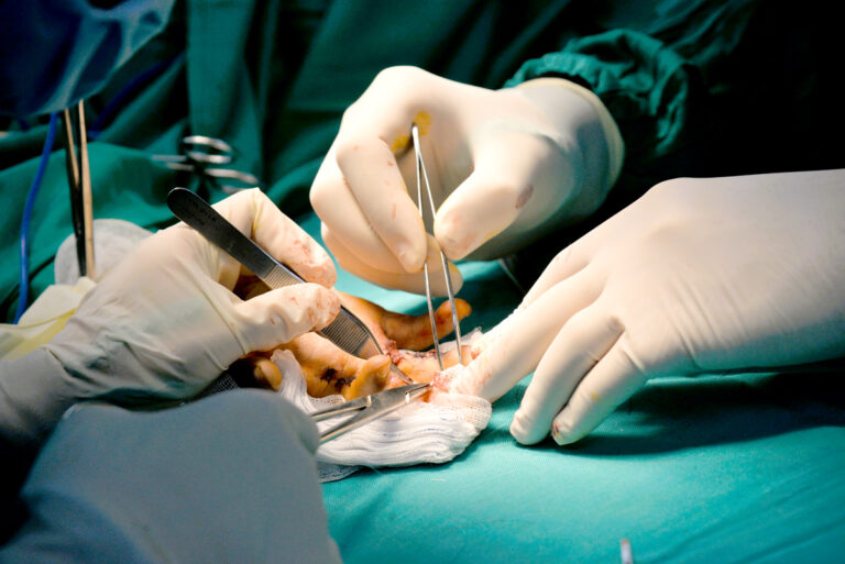 Trung tâm thuộc Hội Cứu trợ trẻ em tàn tật Việt Nam mang điều kỳ diệu đến với trẻ em kém may mắn